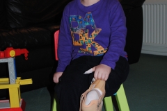 Fitting his new first special leg