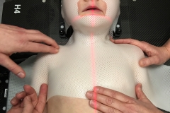 Radiotherapy mask fitting